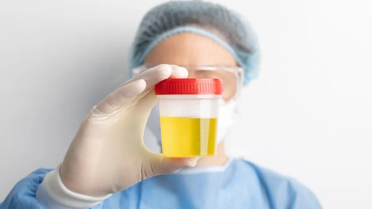 Should You Take A Urine Test On Your Period?