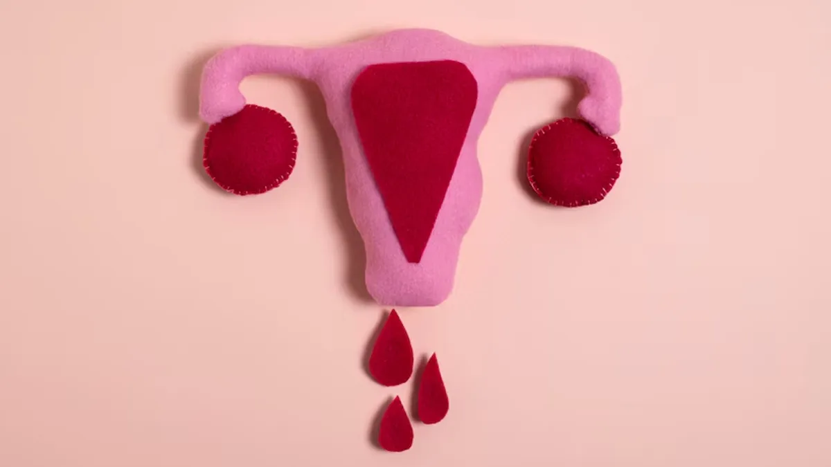 Surgery vs Medical Management: How To Tackle Endometriosis Without Hysterectomy