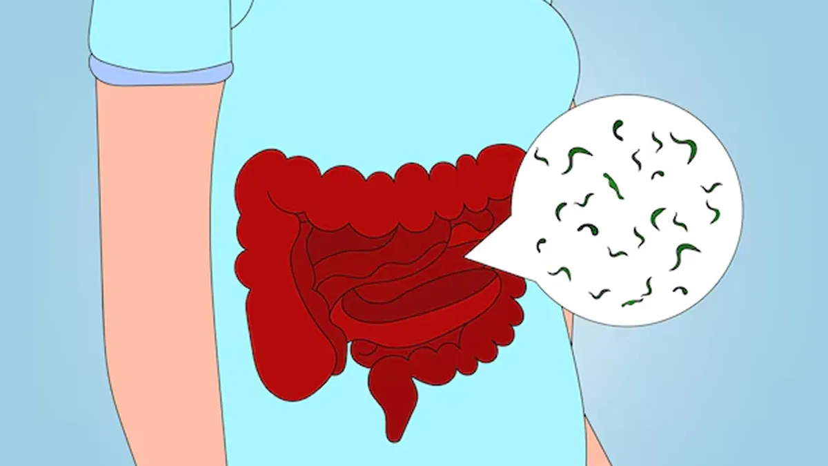 What Is Gut Crowding? Understanding Causes, Symptoms, And Treatment