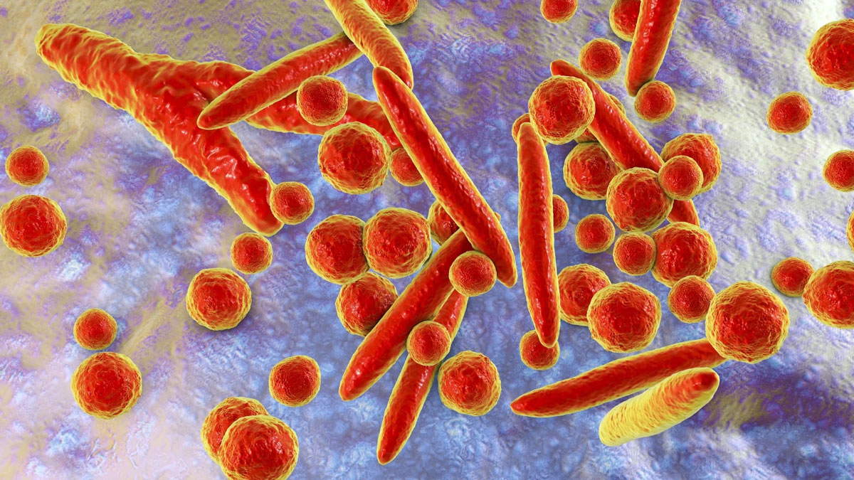 Mycoplasma Pneumonia