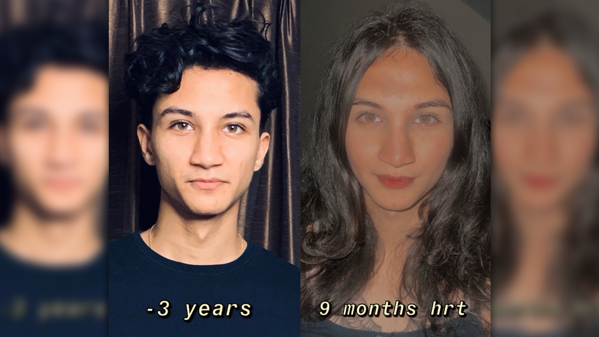 From Aryan To Anaya: Sanjay Bangar's Child Opens Up About Transformation Journey With Hormone Replacement Therapy