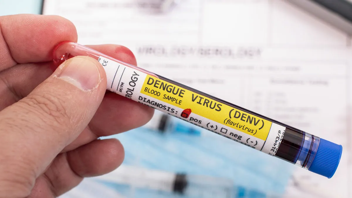 Delhi Sees 472 More Dengue Cases, Total Count At 4,533 | Expert Tips To Stay Protected