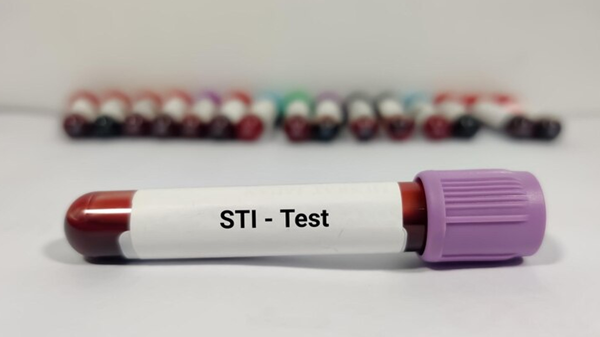5-pregnancy-test