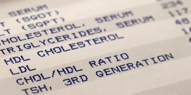 HDL Levels Above 60: Is It a Reason for Concern? Here's What Experts Say