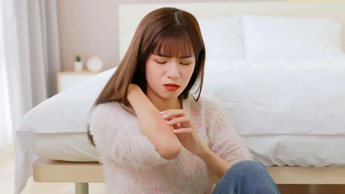 Is Dry, Itchy Skin Ruining Your Winter? Here Are The Causes Of Winter Itch And Tips To Prevent It
