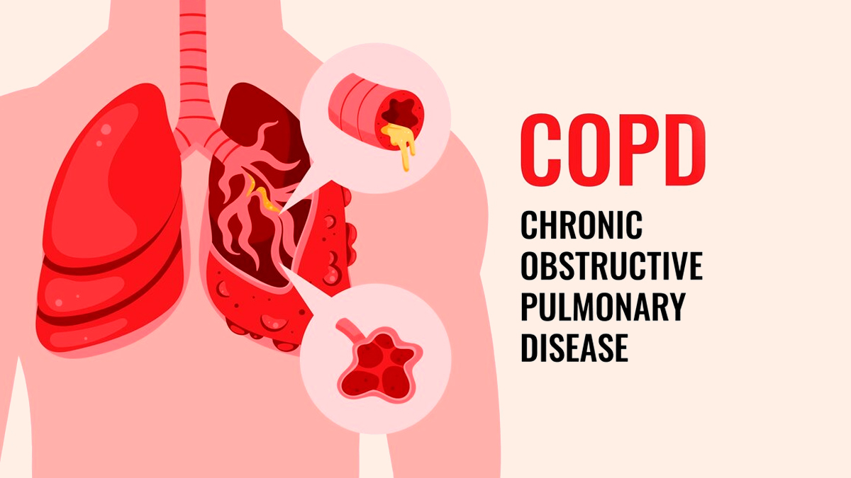 COPD