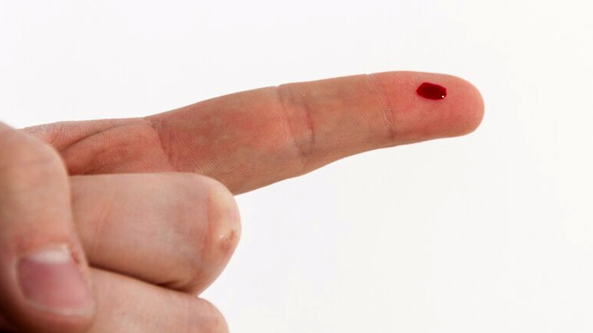 vitamin-k-deficiency