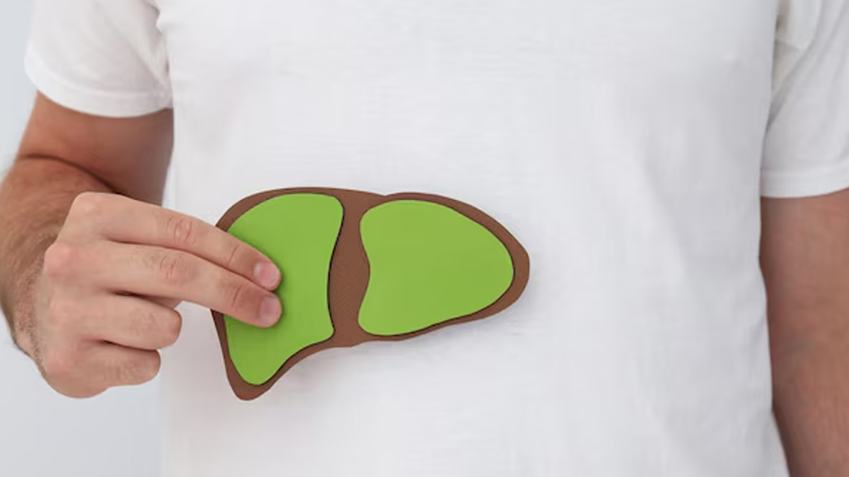 link-between-gynecomastia-fatty-liver