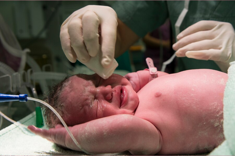 preterm-birth