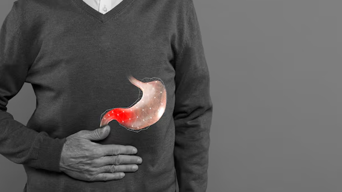 stomach-cancer