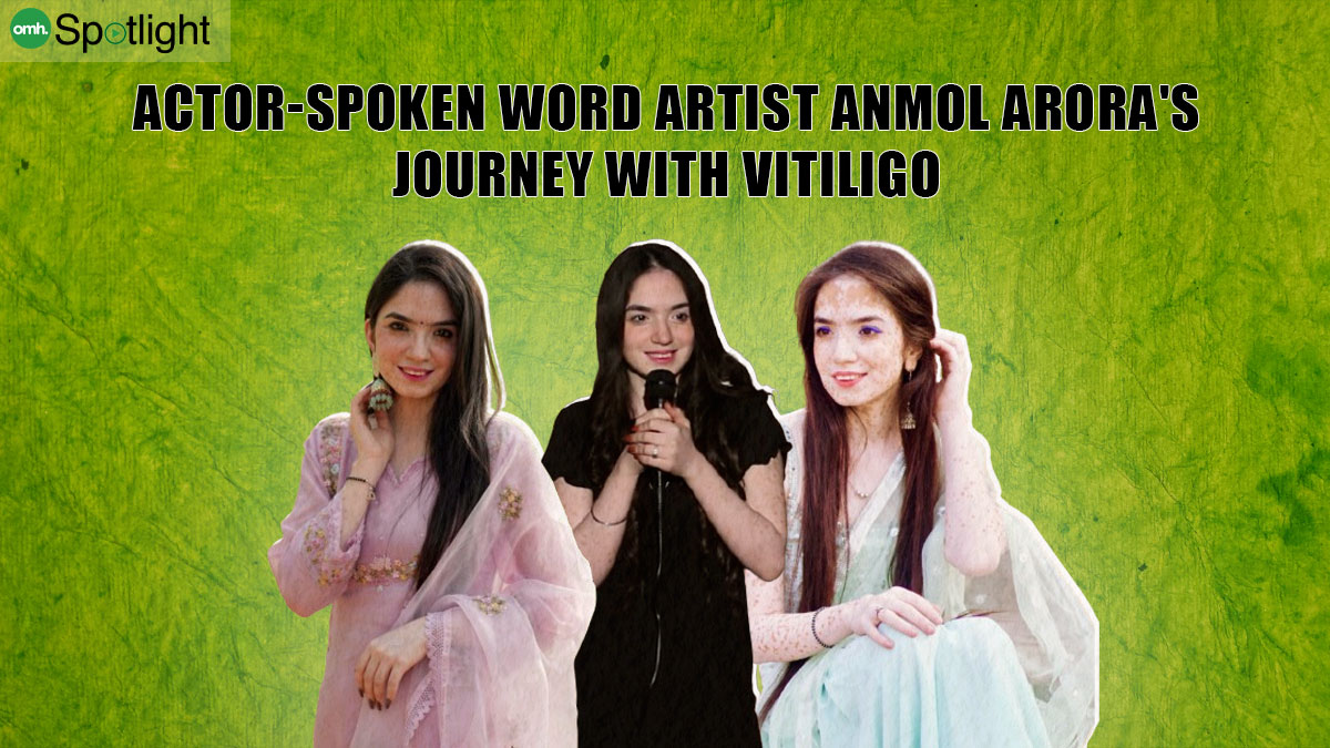 “While My Looks Were Not In My Control, Education Was”: Actor-Spoken Word Artist Anmol Arora's Journey With Vitiligo