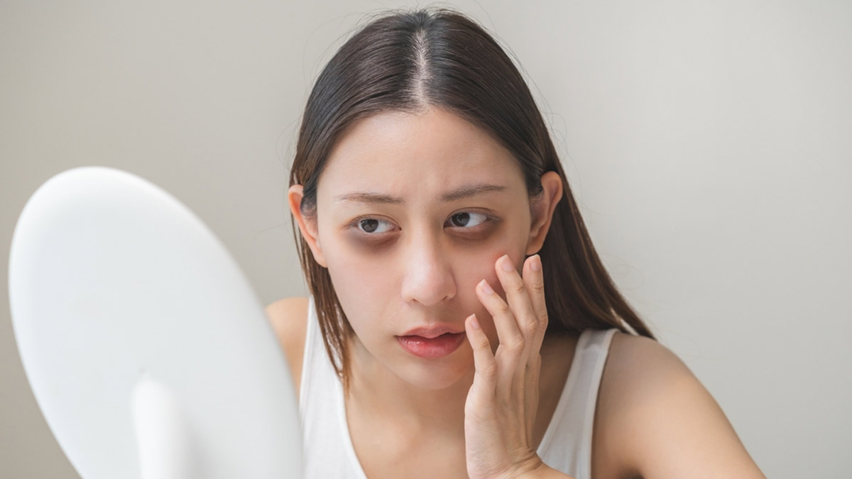 Dark Circles: How Tea Bags, Tomatoes, And Potatoes Can Be Best Solution