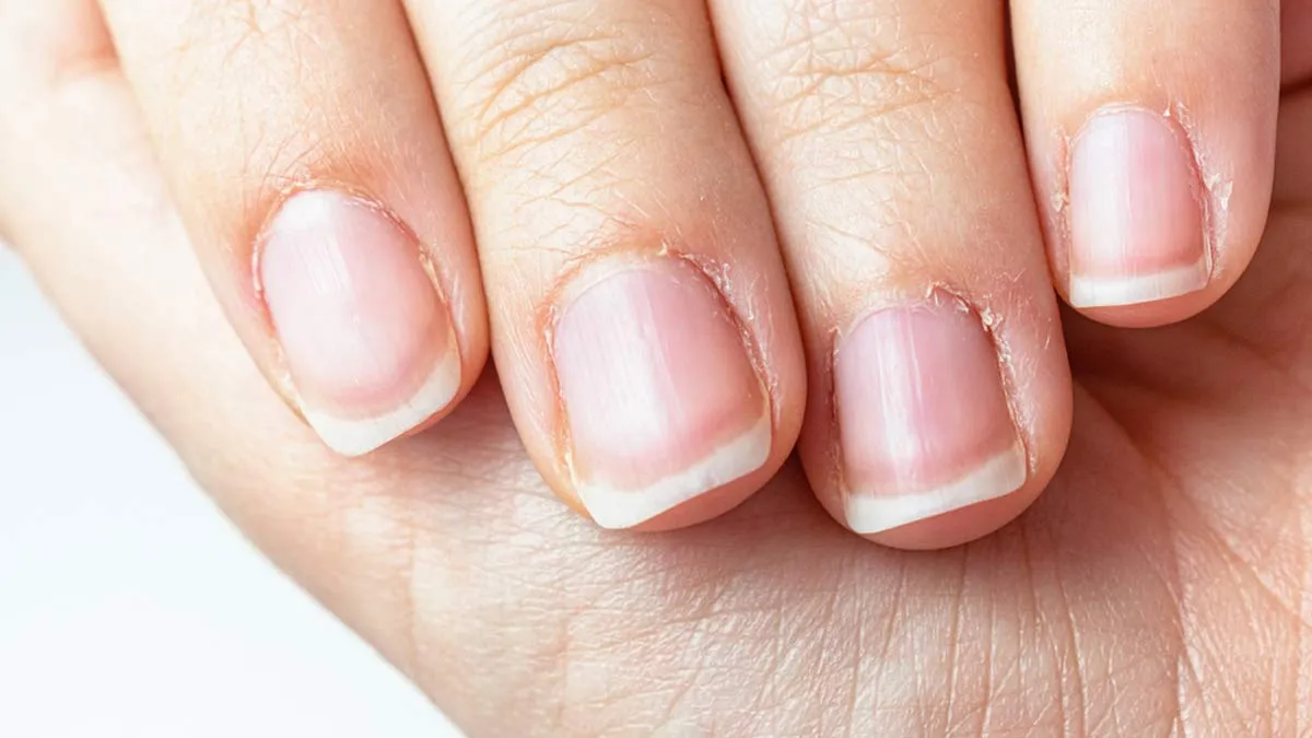 How to Prevent Hangnails Naturally: Essential Oils and DIY Treatments for Smooth Cuticles