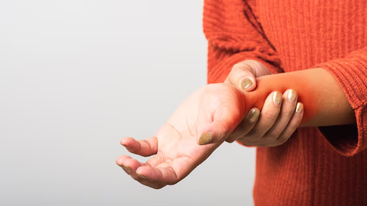 Carpal-Tunnel-Syndrome