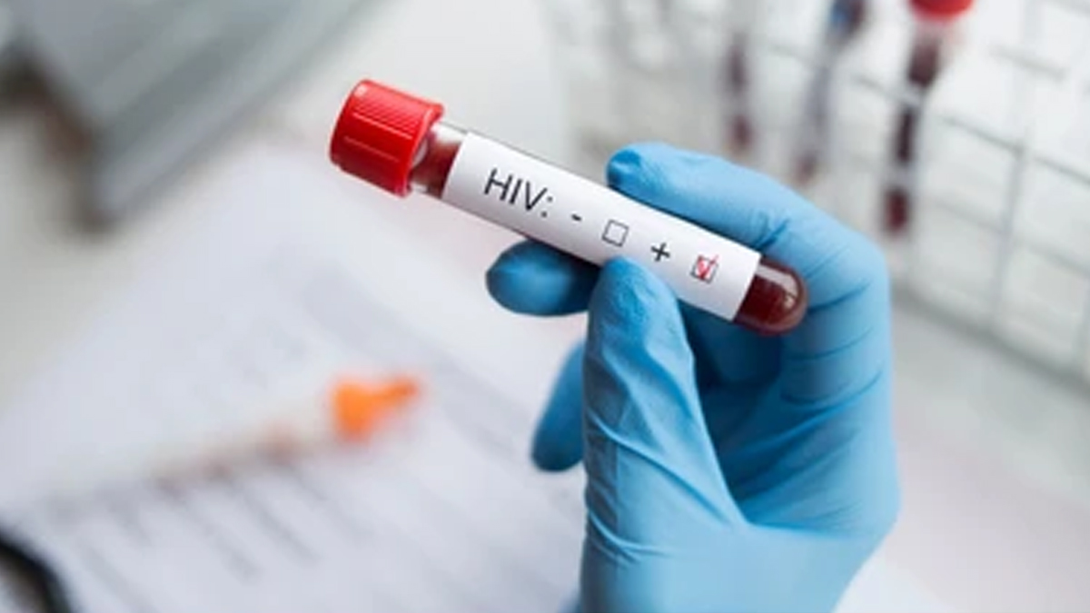 HIV-Infection
