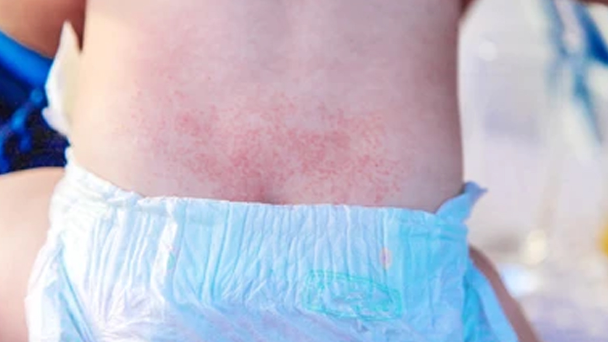 2-diaper