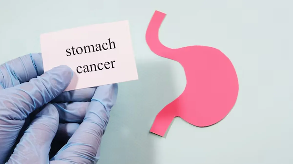 Rising Stomach Cancer Cases in India: Unhealthy Lifestyles, Stress, and Key Risk Factors