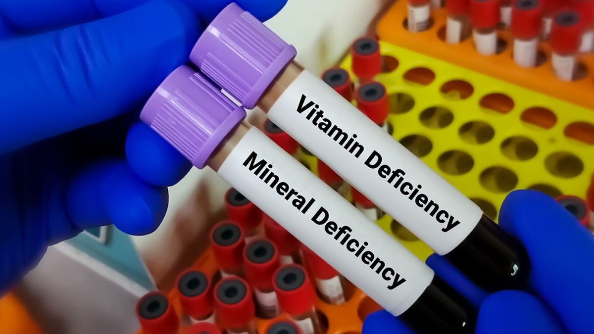 vitamin-and-mineral-deficiency
