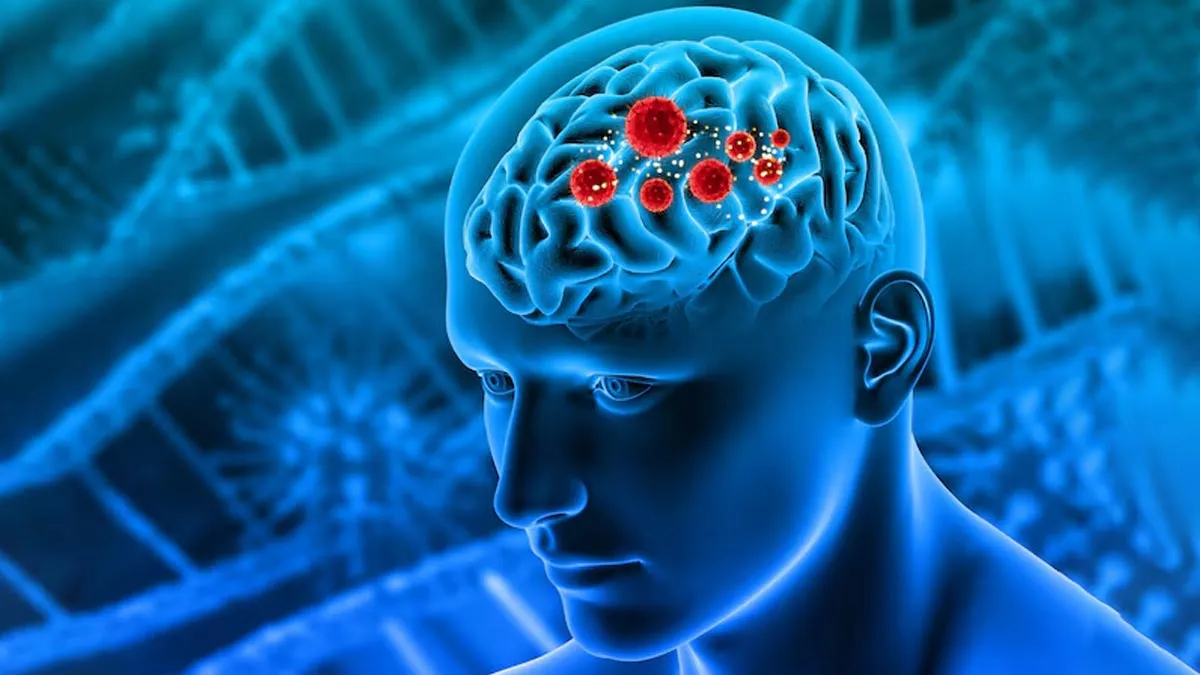 Neuroendocrine Neoplasms (NENs): Symptoms, Diagnosis, and Treatment Options