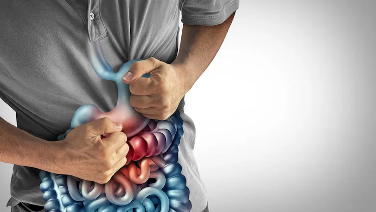 What Is The Difference Between Irritable Bowel Syndrome (IBS) and Inflammatory Bowel Disease (IBD), Doctor Explains