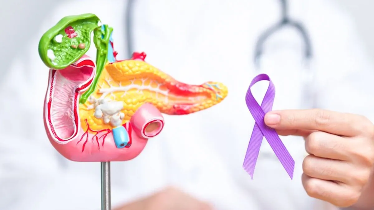 Could Your Legs Be Telling You Something? Expert Lists 5 Signs Of Pancreatic Cancer You Shouldn't Ignore