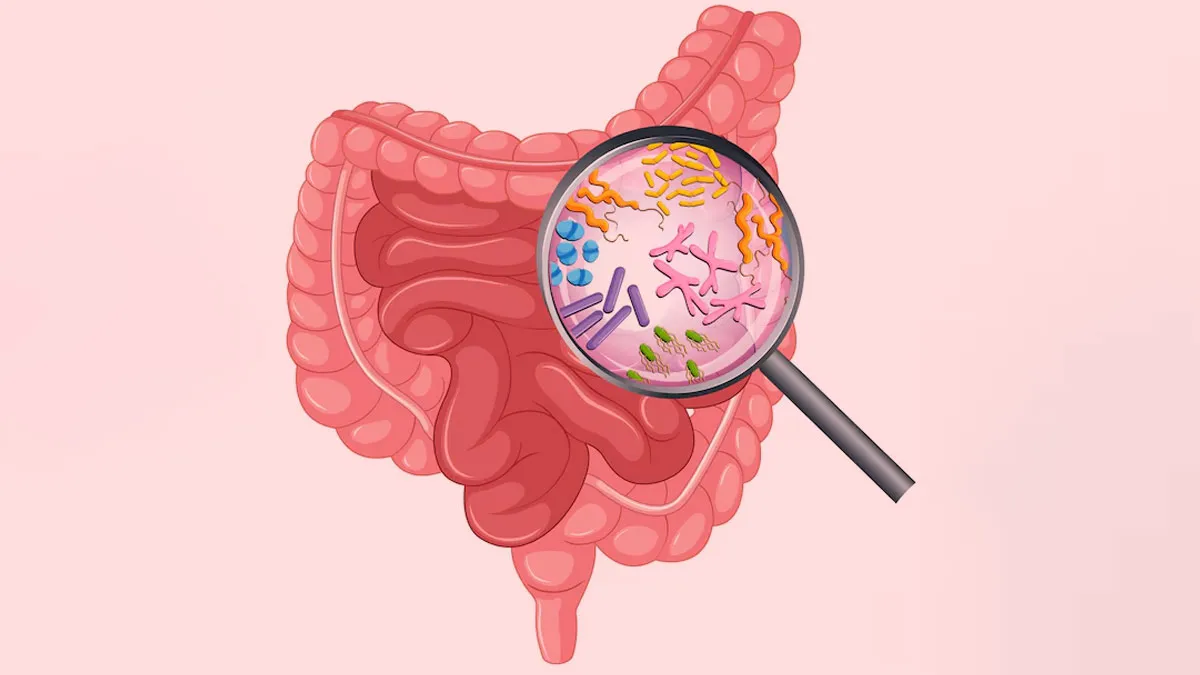 Natural Solutions: Herbal Remedies To Manage SIBO And Restore Digestive Balance