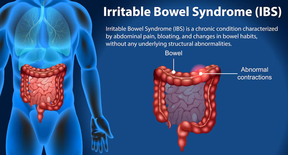 What Is The Difference Between Irritable Bowel Syndrome Ibs And