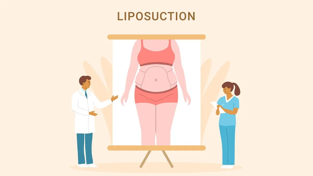 What You Need To Know Before Getting Liposuction: Expert Advice For A Successful Journey