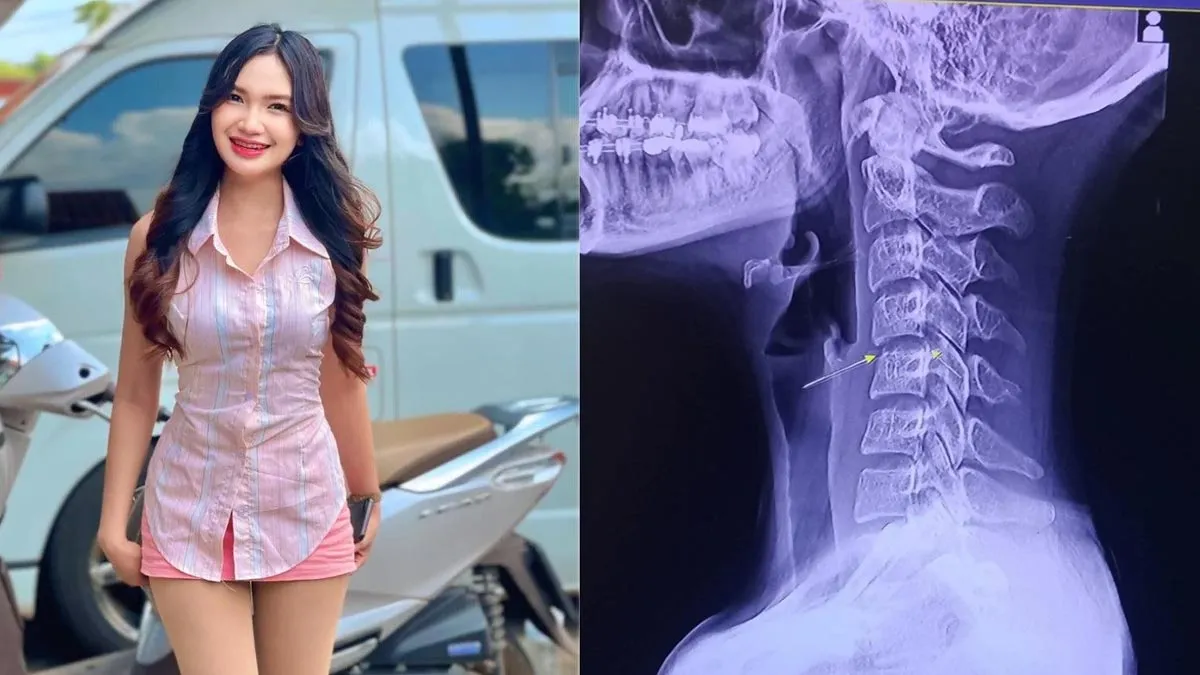 20-Year-Old Singer Dies from Brain Swelling After Intense Neck Massage in Thailand; Here’s What Happened
