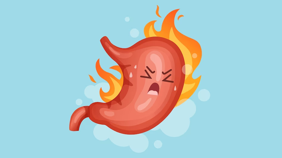 1-gastritis