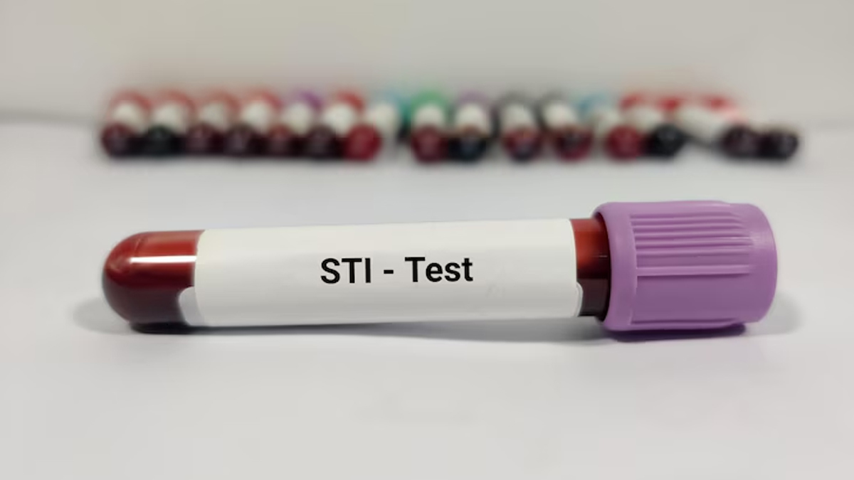 1-STI pregnancy