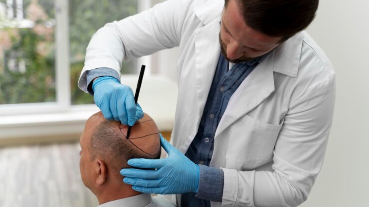 hair transplant surgery