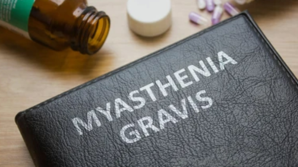 myasthenia-gravis