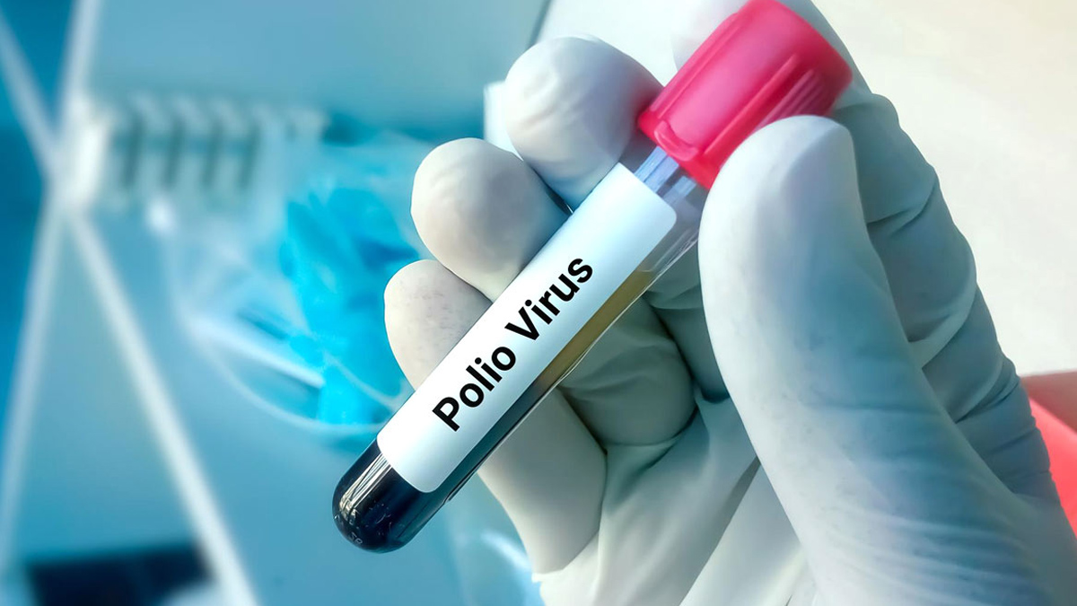 2-poliovirus
