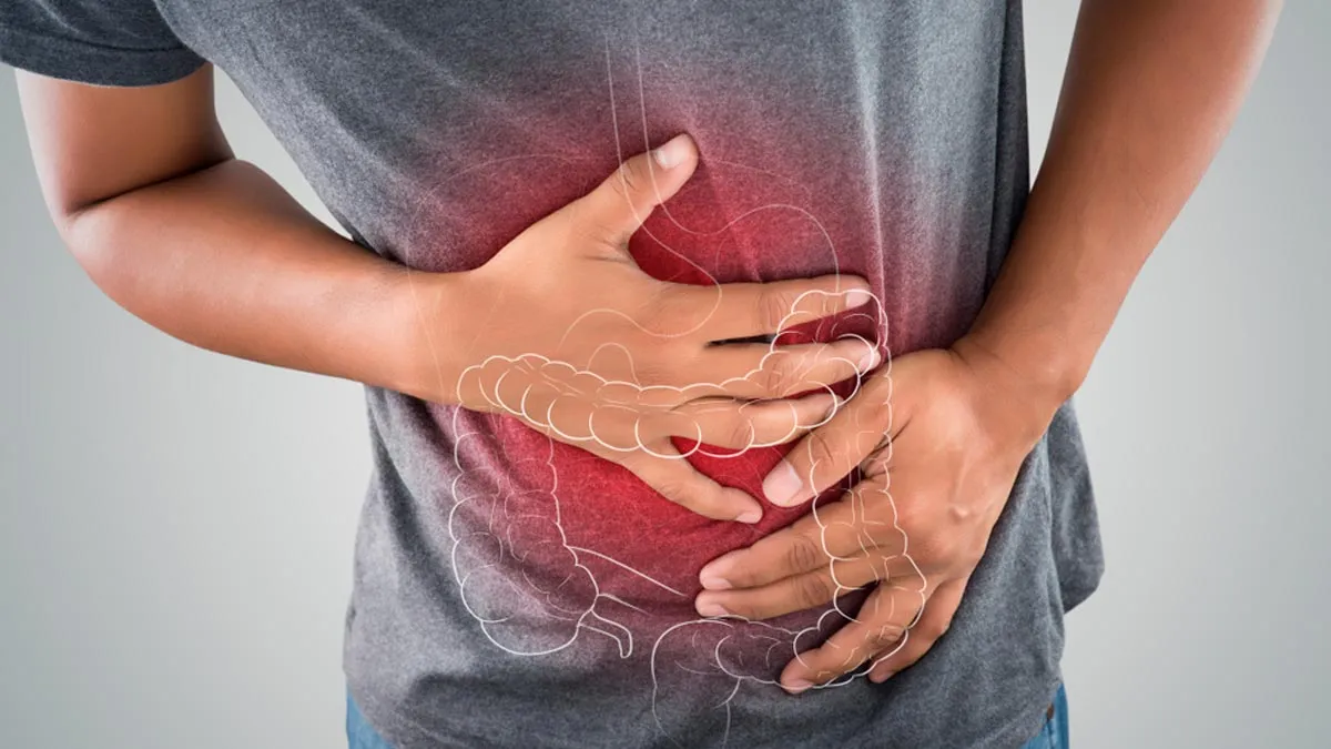 Study: Bowel Cancer, Second Deadliest, Rising Faster Among 25-49 Age Group, Understanding Risk Factors