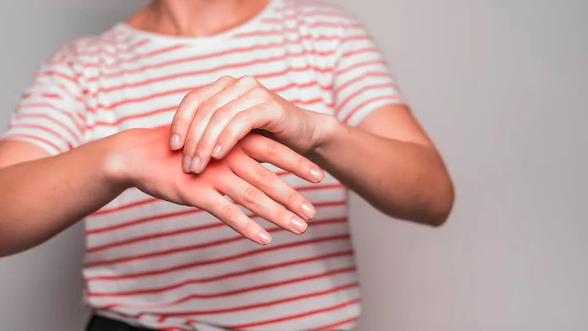 Experiencing Burning Limb Pain? Here Are Natural Remedies For Managing Erythromelalgia