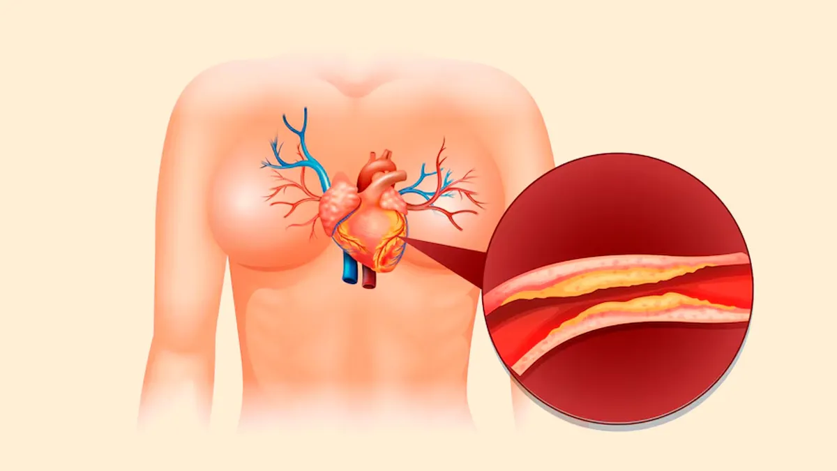 Winter’s Silent Threat: Recognising Five Nighttime Warning Signs Of Clogged Arteries