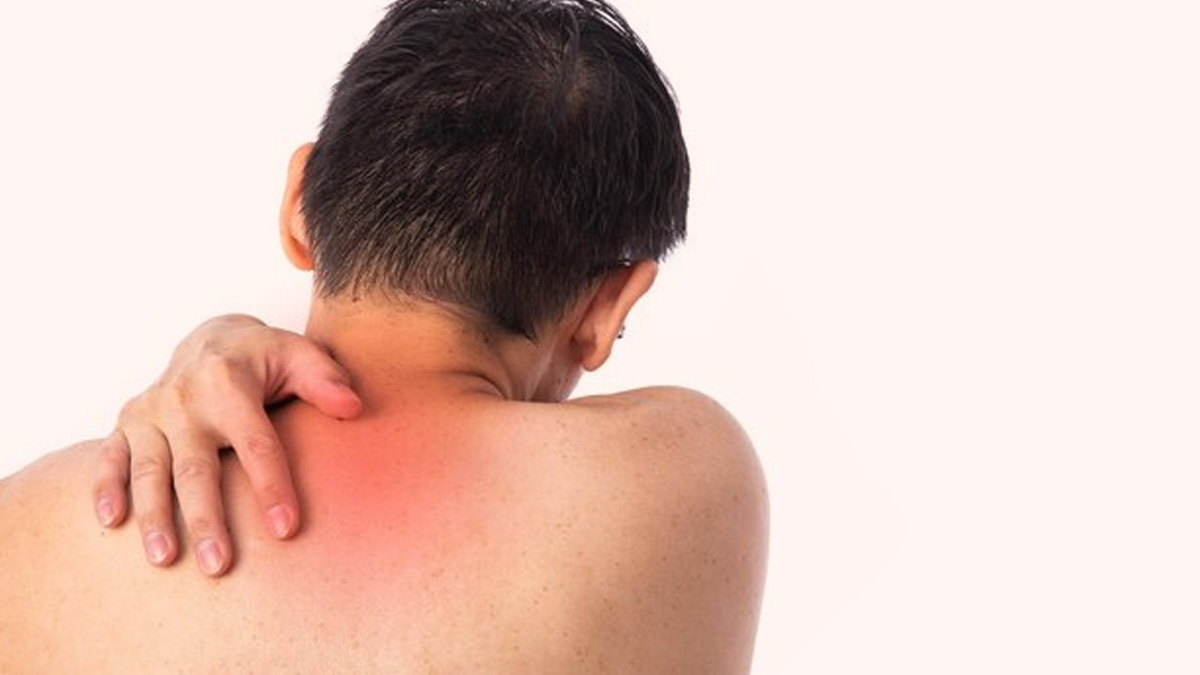 Itchy Back Syndrome: Try These DIY Natural Remedies For Managing ...