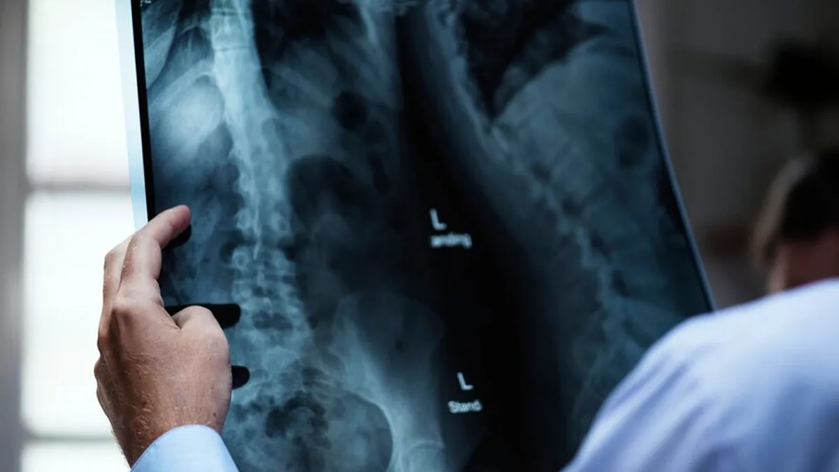 Metastatic Spine Cancer: Recognising Risks, Symptoms, and Life-Saving Treatments