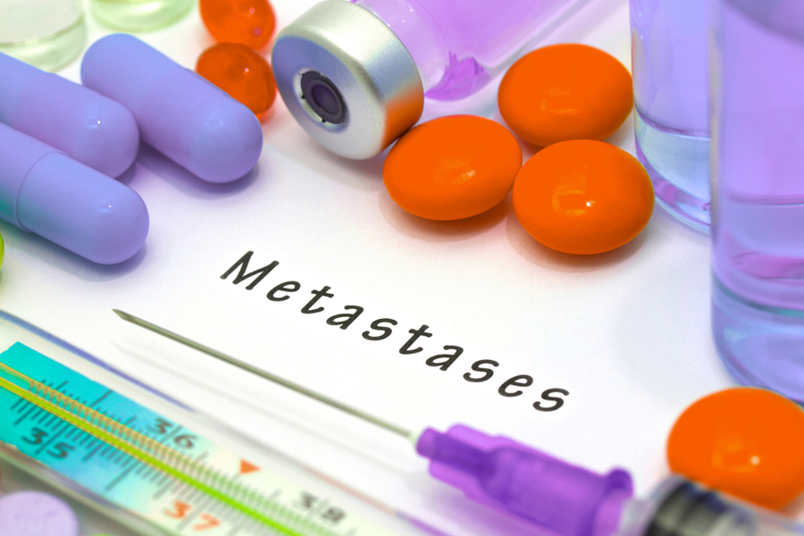 metastases