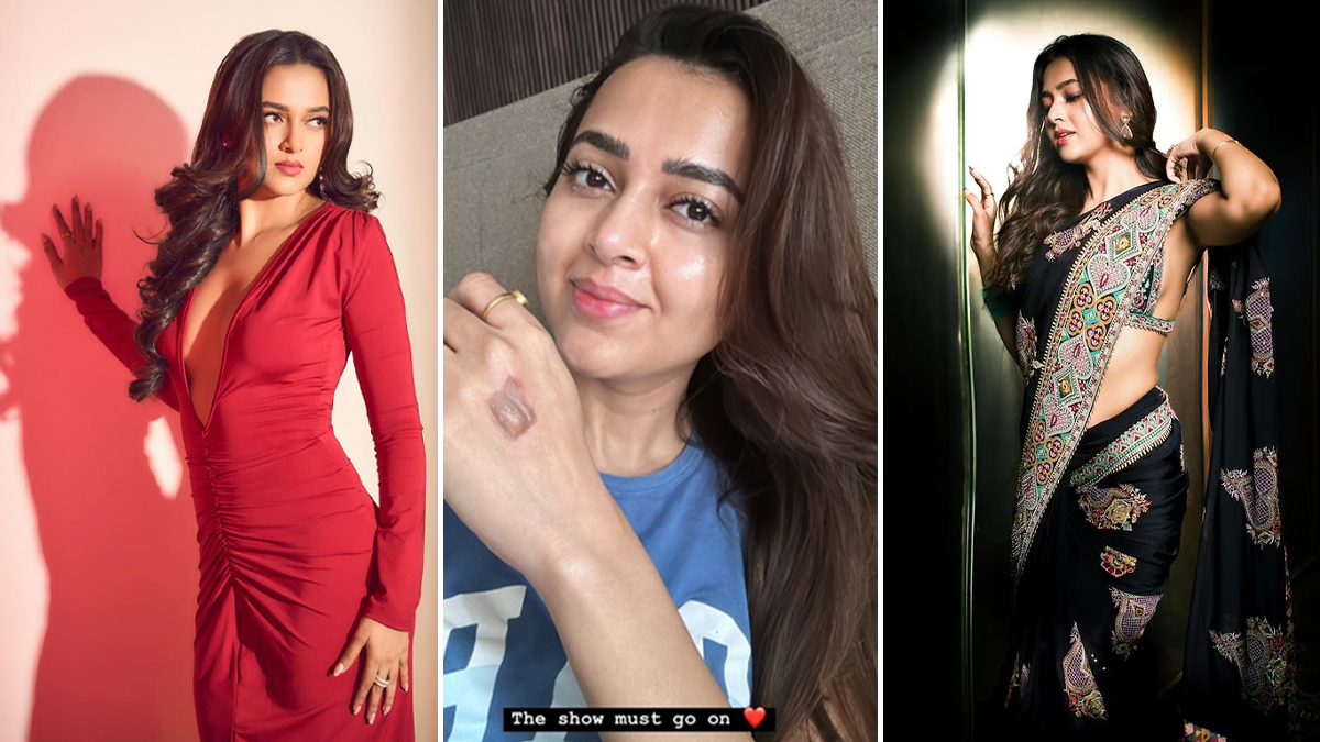 Tejasswi Prakash Sustains Burn Injury on the Set of Celebrity MasterChef: Tips To Prevent Burn Injuries In The Kitchen