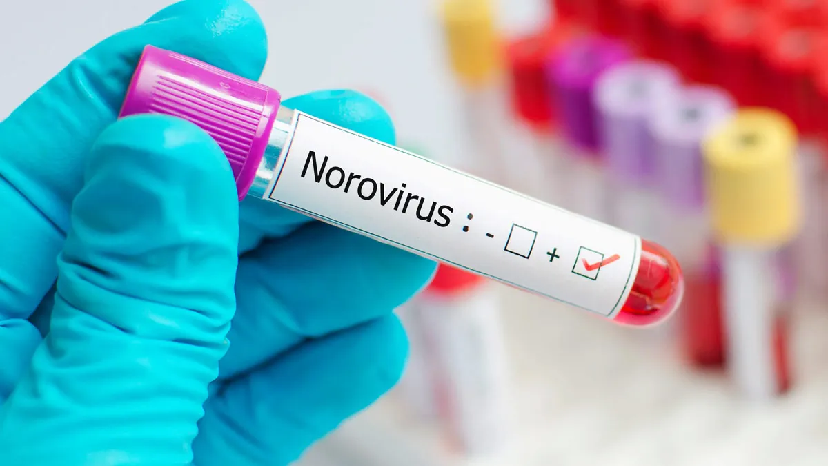 Cases Of Norovirus Increasing Significantly Across The United States: CDC Data Shows