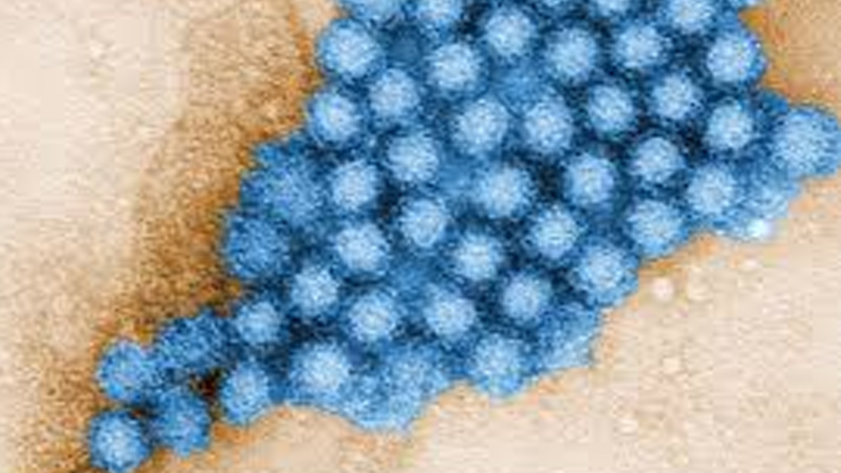 mn-norovirus