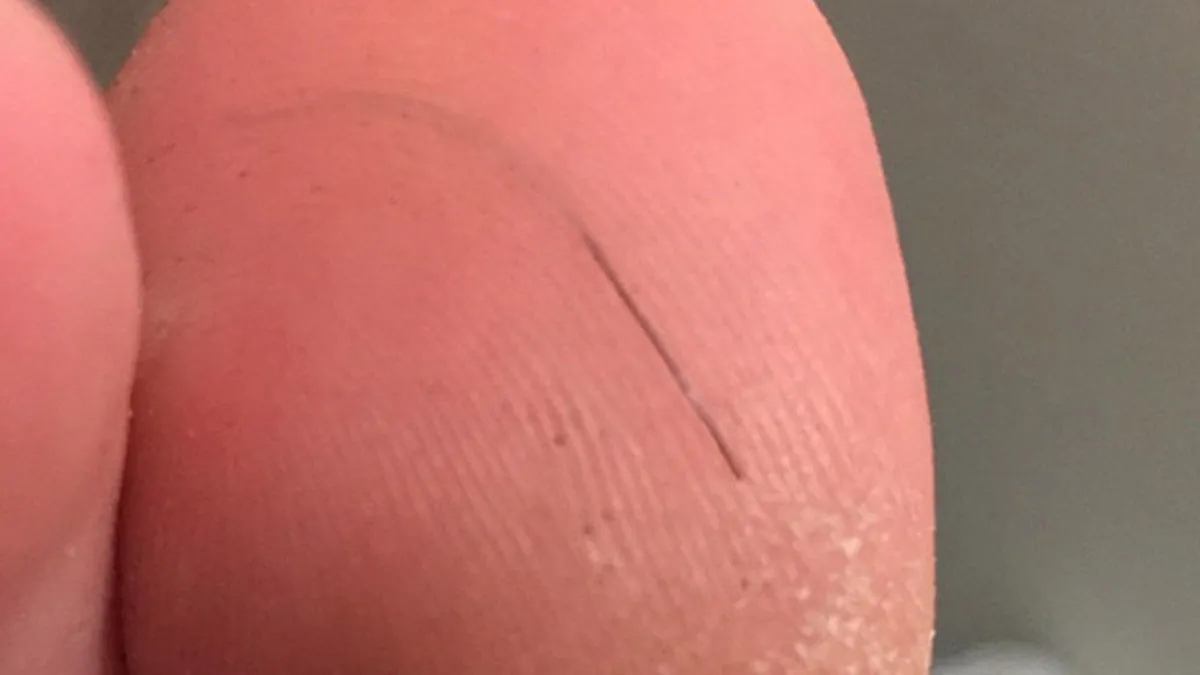 Can Hair Strands Pierce Your Skin And Cause Splinters? Hair Splinters Explained