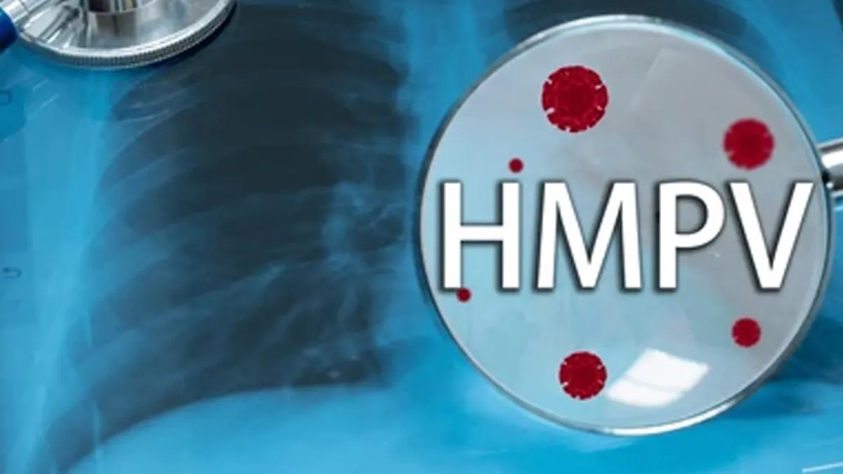HMPV FAQs: Frequently Asked Questions And Their Answers About Human Metapneumovirus By Health Experts