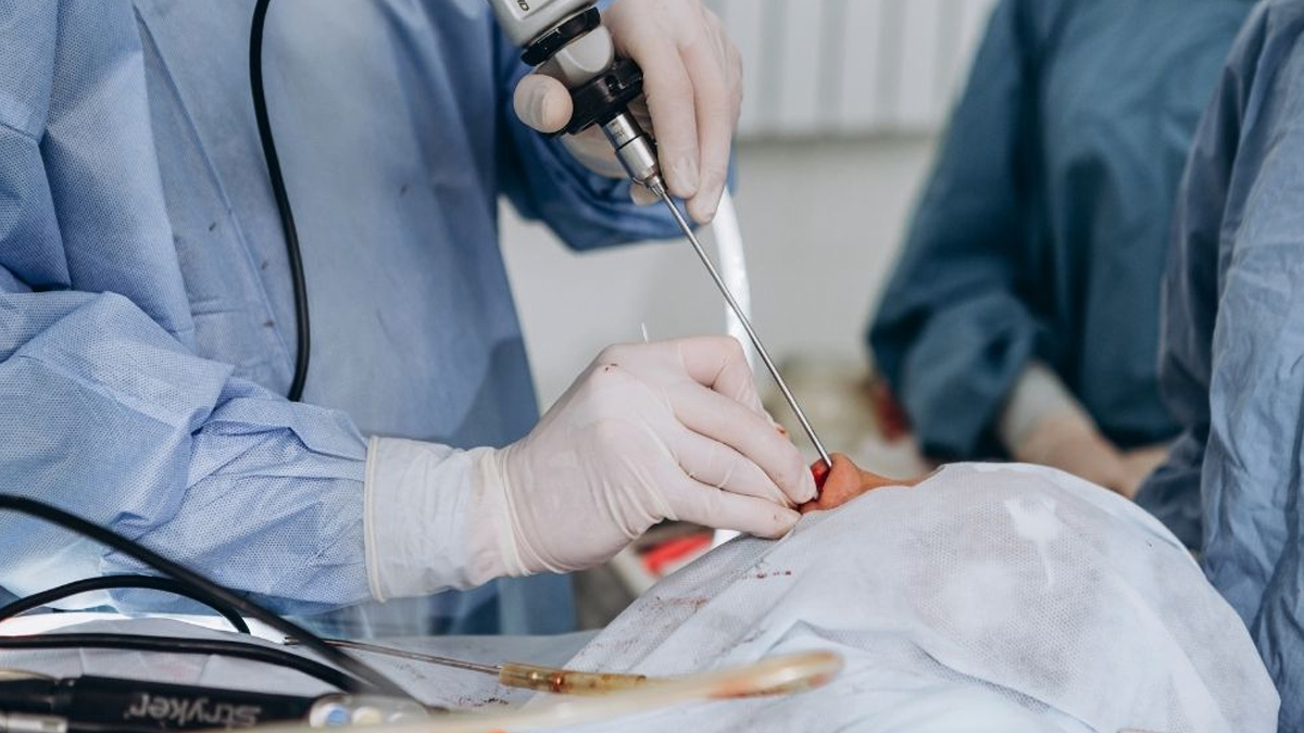 2-sinus-surgery
