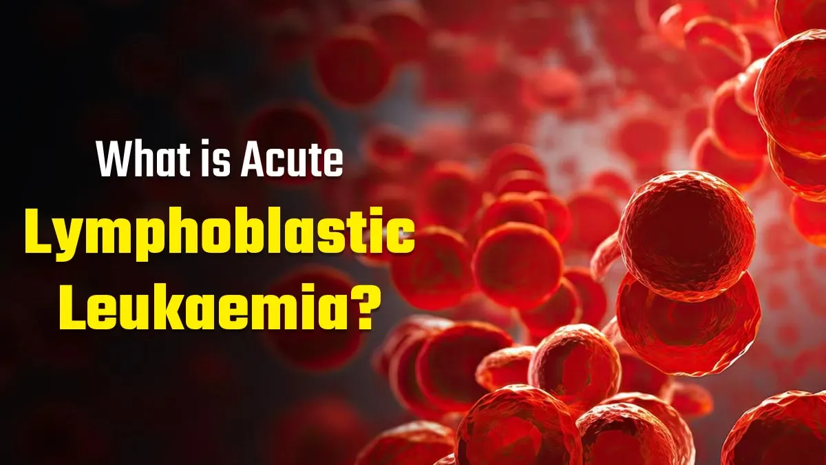 What Is Acute Lymphoblastic Leukaemia: Exploring Its Symptoms, Survival Rate, Life Expectancy, and Treatment