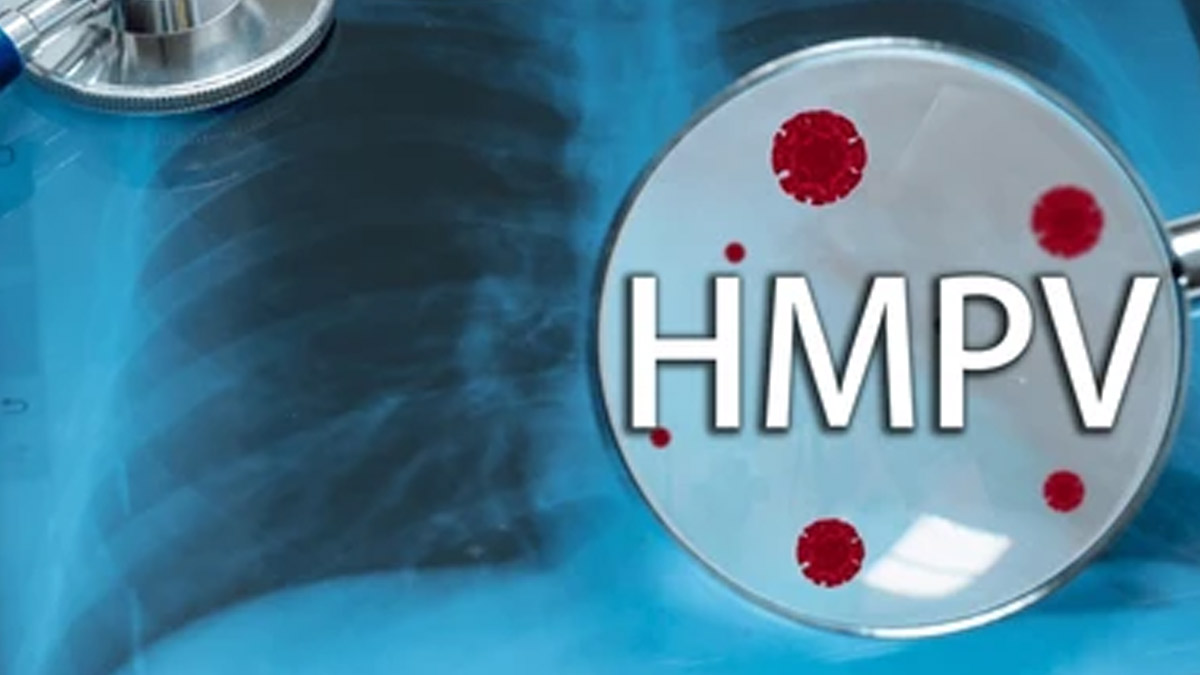 Is HMPV Fatal Understanding The Health Complications Of HMPV is-hmpv-fatal-understanding-the-health-complications-of-hmpv