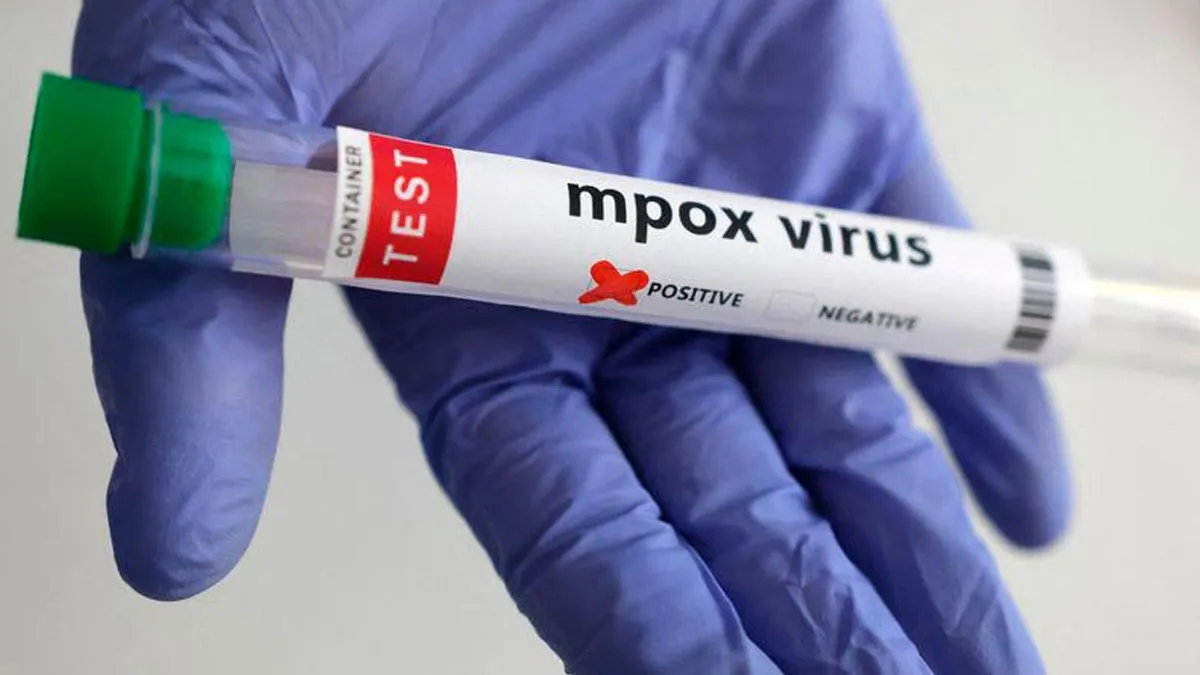 Mpox In Africa: Sierra Leone Declares Public Health Emergency Over Mpox Outbreak