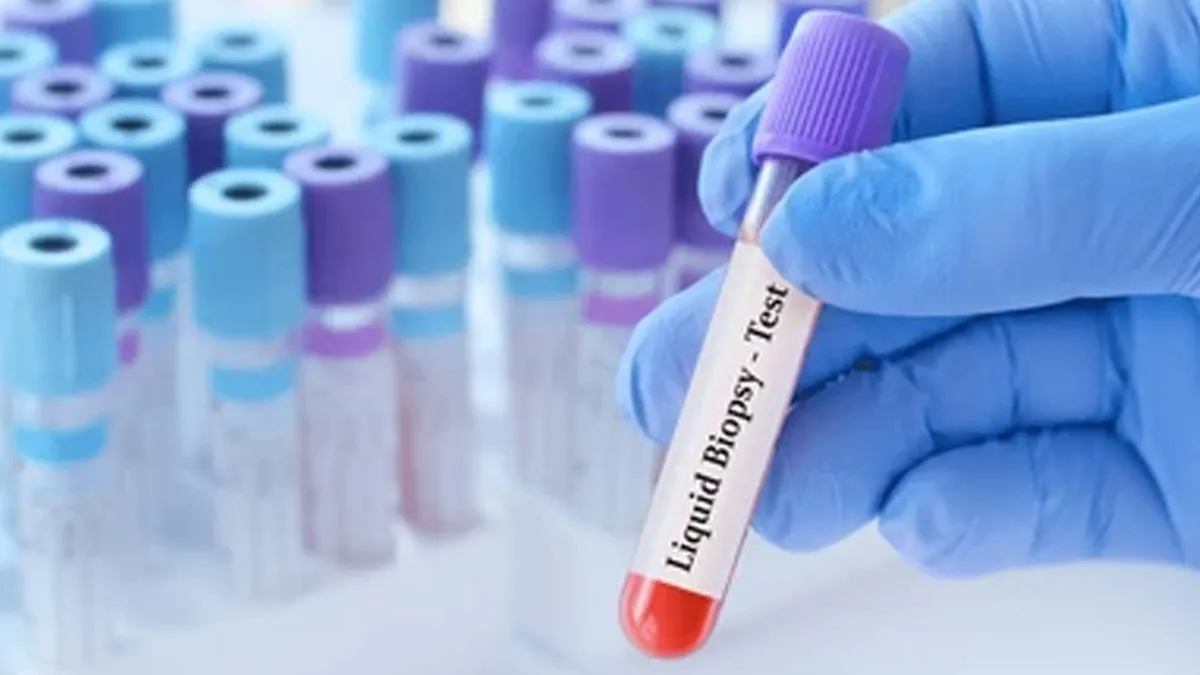 How Accurate Is Liquid Biopsy In Diagnosing Lung Cancer?